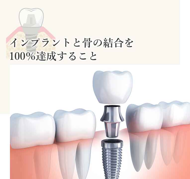 セラミック治療