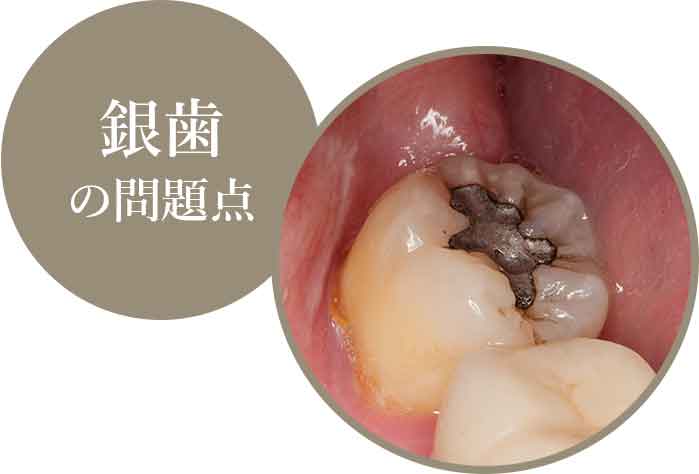 保険の材料の問題点