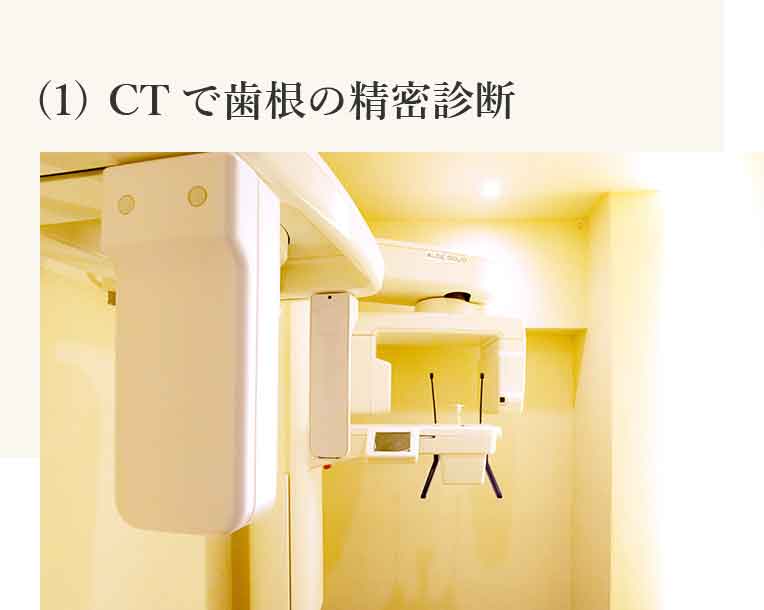 CTで歯根の精密診断