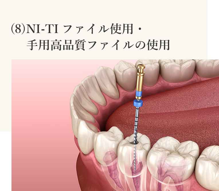 NI-TIファイル使用・手用高品質ファイルの使用